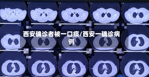 西安确诊者被一口痰/西安一确诊病例