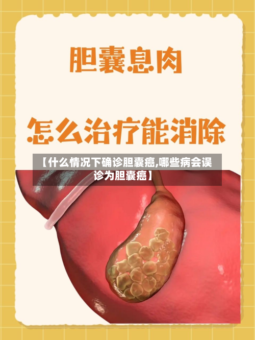 【什么情况下确诊胆囊癌,哪些病会误诊为胆囊癌】