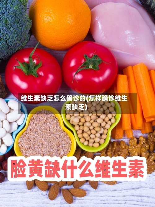 维生素缺乏怎么确诊的(怎样确诊维生素缺乏)-第2张图片