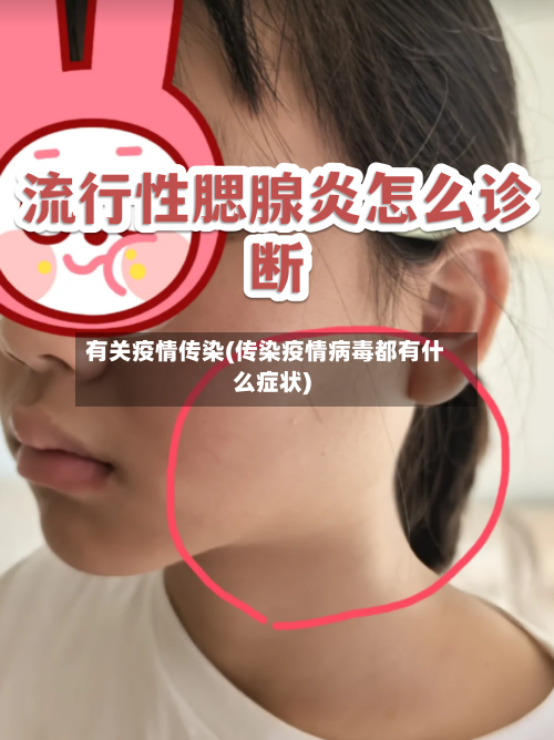 有关疫情传染(传染疫情病毒都有什么症状)-第2张图片